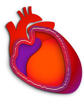 Pericarditis 1 Medical - Cardiovascular