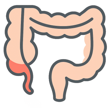 Appendicitis